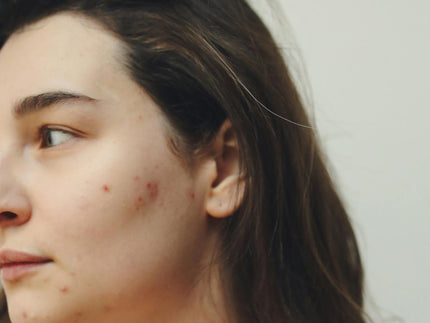 Stress and Your Skin: Simple Steps You Can Take to Find Balance Again